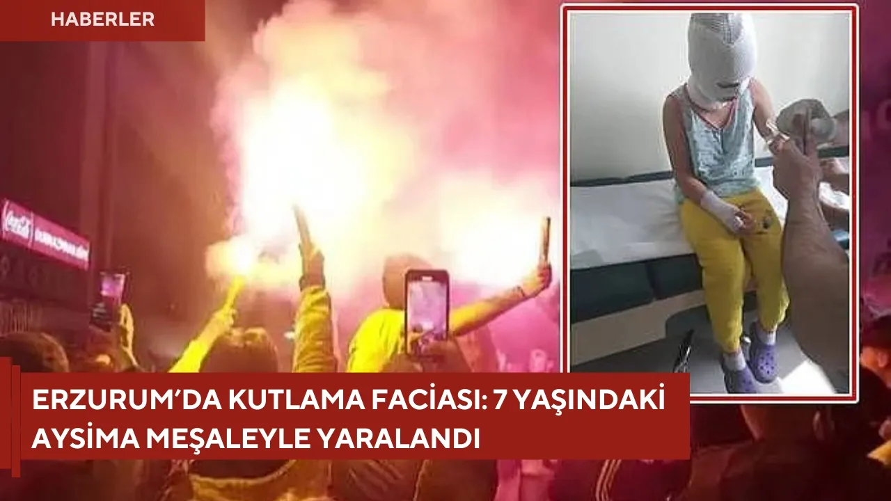 Erzurum’da Kutlama Faciası: 7 Yaşındaki Aysima Meşaleyle Yaralandı