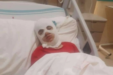 "Küçük Aysima’nın Haykırışı: Şampiyonluk Coşkusunda Yüzü Yanan Çocuğun Sorumluları 2,5 Aydır Kayıp!"